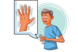 Giai đoạn phát triển của hội chứng Parkinson